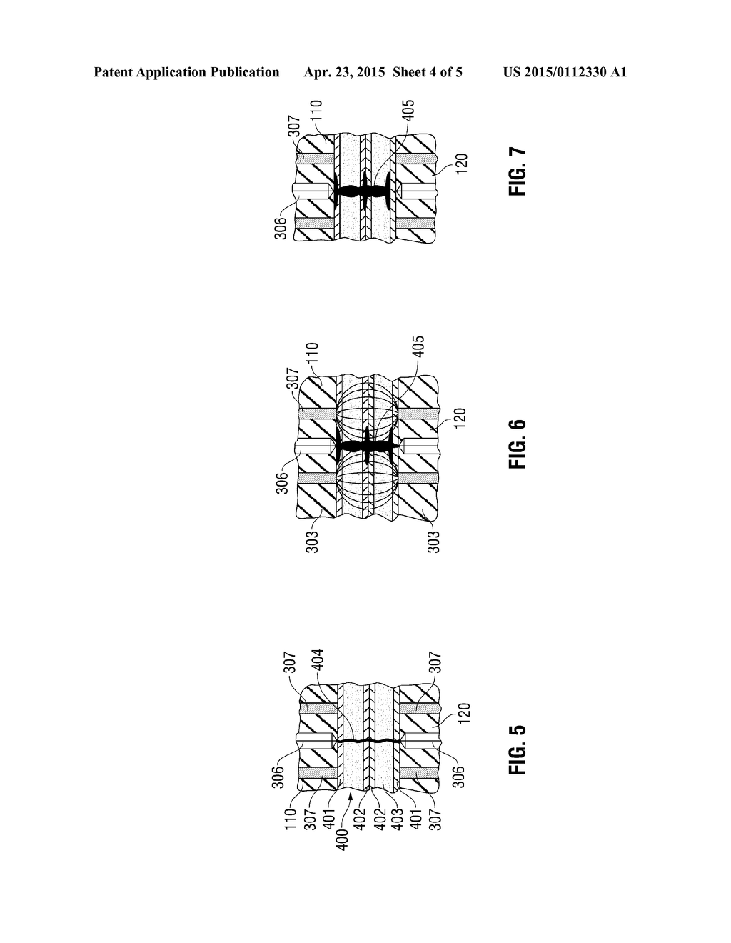 METHOD AND APPARATUS FOR VASCULAR TISSUE SEALING WITH REDUCED ENERGY     CONSUMPTION - diagram, schematic, and image 05