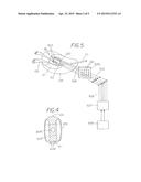 Method for Treating a Tubular Anatomical Structure diagram and image