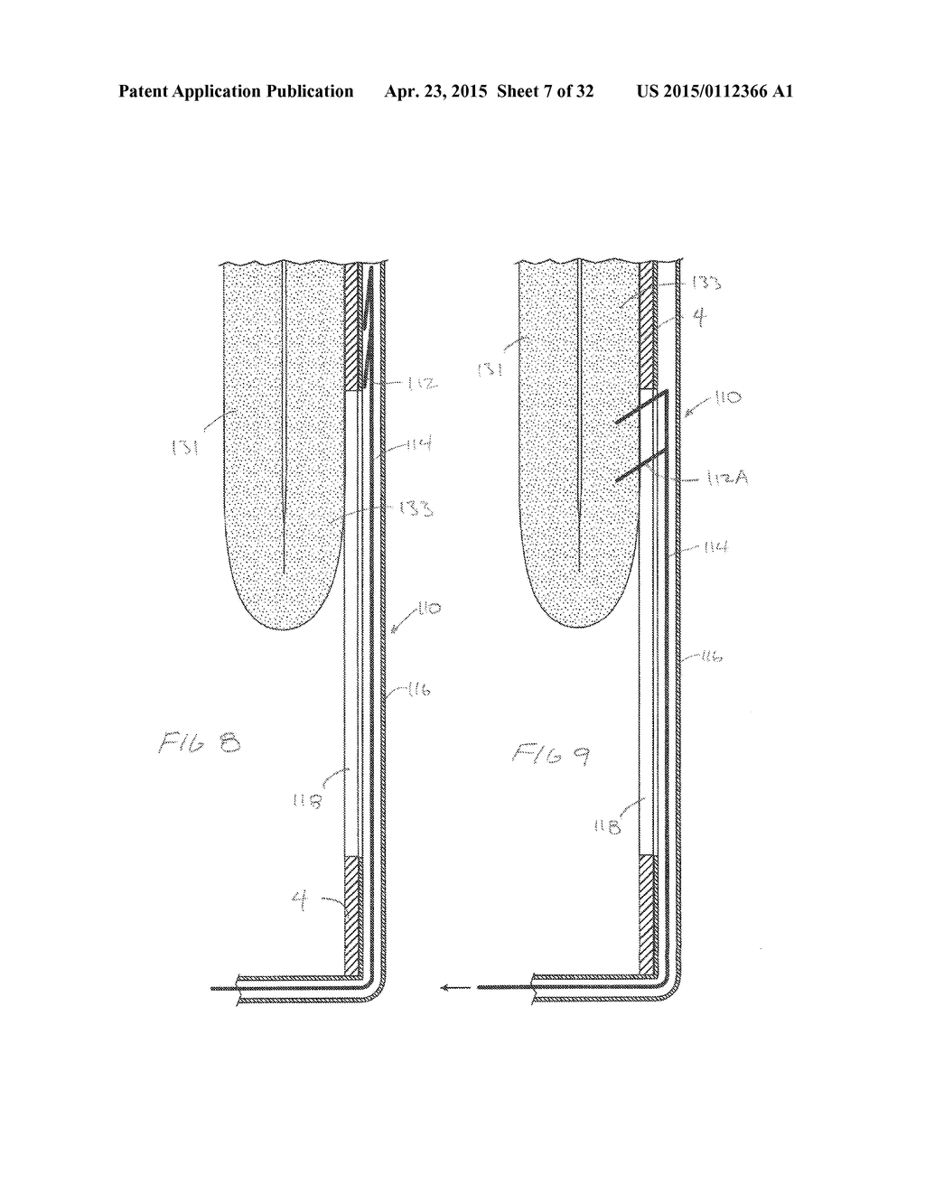 METHODS AND DEVICES FOR MANIPULATING AND FASTENING TISSUE - diagram, schematic, and image 08