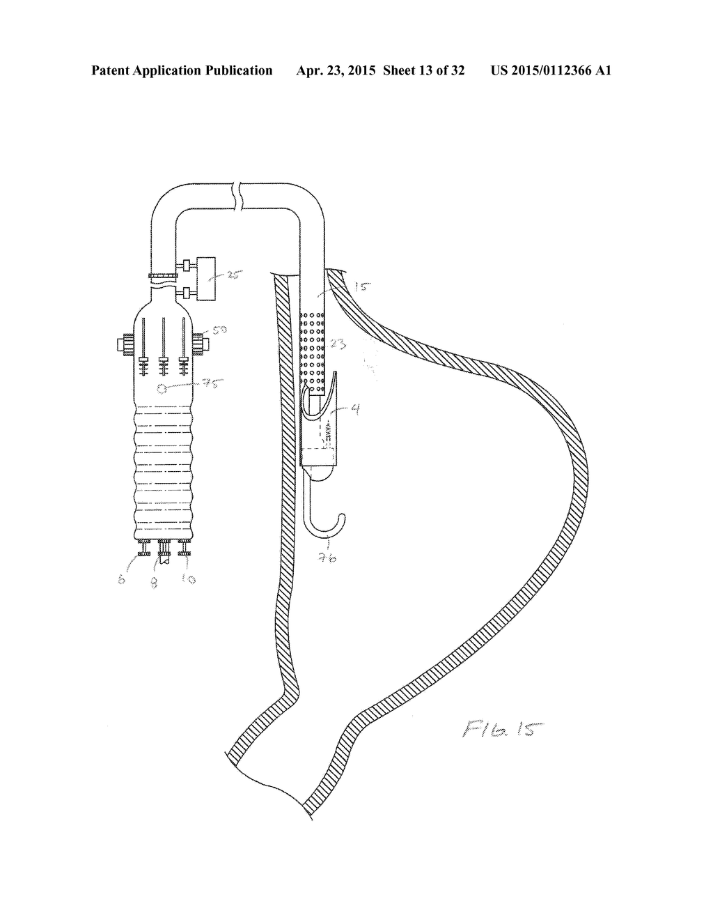 METHODS AND DEVICES FOR MANIPULATING AND FASTENING TISSUE - diagram, schematic, and image 14