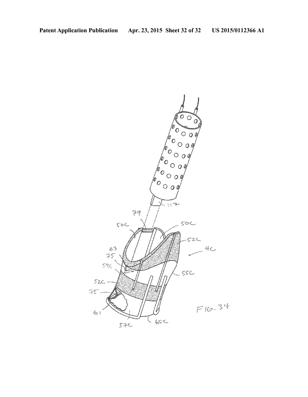 METHODS AND DEVICES FOR MANIPULATING AND FASTENING TISSUE - diagram, schematic, and image 33