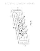 ANTI-REFLUX/HEARTBURN TREATMENT DEVICE diagram and image