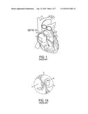 CLOSURE DEVICE diagram and image