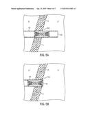 CLOSURE DEVICE diagram and image