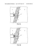 CLOSURE DEVICE diagram and image