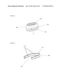 POLYAXIAL LOCKING ASSEMBLY diagram and image