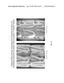 COATINGS CONTAINING MULTIPLE DRUGS diagram and image