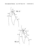 METHODS AND SYSTEMS FOR HEART VALVE THERAPY diagram and image