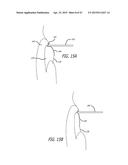 METHODS AND SYSTEMS FOR HEART VALVE THERAPY diagram and image