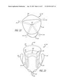 METHODS AND SYSTEMS FOR HEART VALVE THERAPY diagram and image