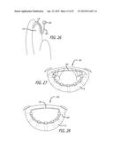 METHODS AND SYSTEMS FOR HEART VALVE THERAPY diagram and image