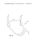 METHODS AND SYSTEMS FOR HEART VALVE THERAPY diagram and image