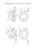 METHODS AND SYSTEMS FOR HEART VALVE THERAPY diagram and image