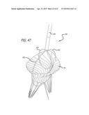 METHODS AND SYSTEMS FOR HEART VALVE THERAPY diagram and image