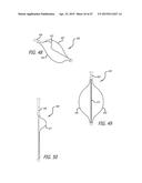 METHODS AND SYSTEMS FOR HEART VALVE THERAPY diagram and image