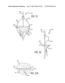 METHODS AND SYSTEMS FOR HEART VALVE THERAPY diagram and image