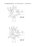 METHODS AND SYSTEMS FOR HEART VALVE THERAPY diagram and image