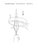 METHODS AND SYSTEMS FOR HEART VALVE THERAPY diagram and image