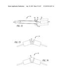 METHODS AND SYSTEMS FOR HEART VALVE THERAPY diagram and image