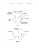 COAPTATION ENHANCEMENT IMPLANT, SYSTEM, AND METHOD diagram and image