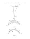 COAPTATION ENHANCEMENT IMPLANT, SYSTEM, AND METHOD diagram and image