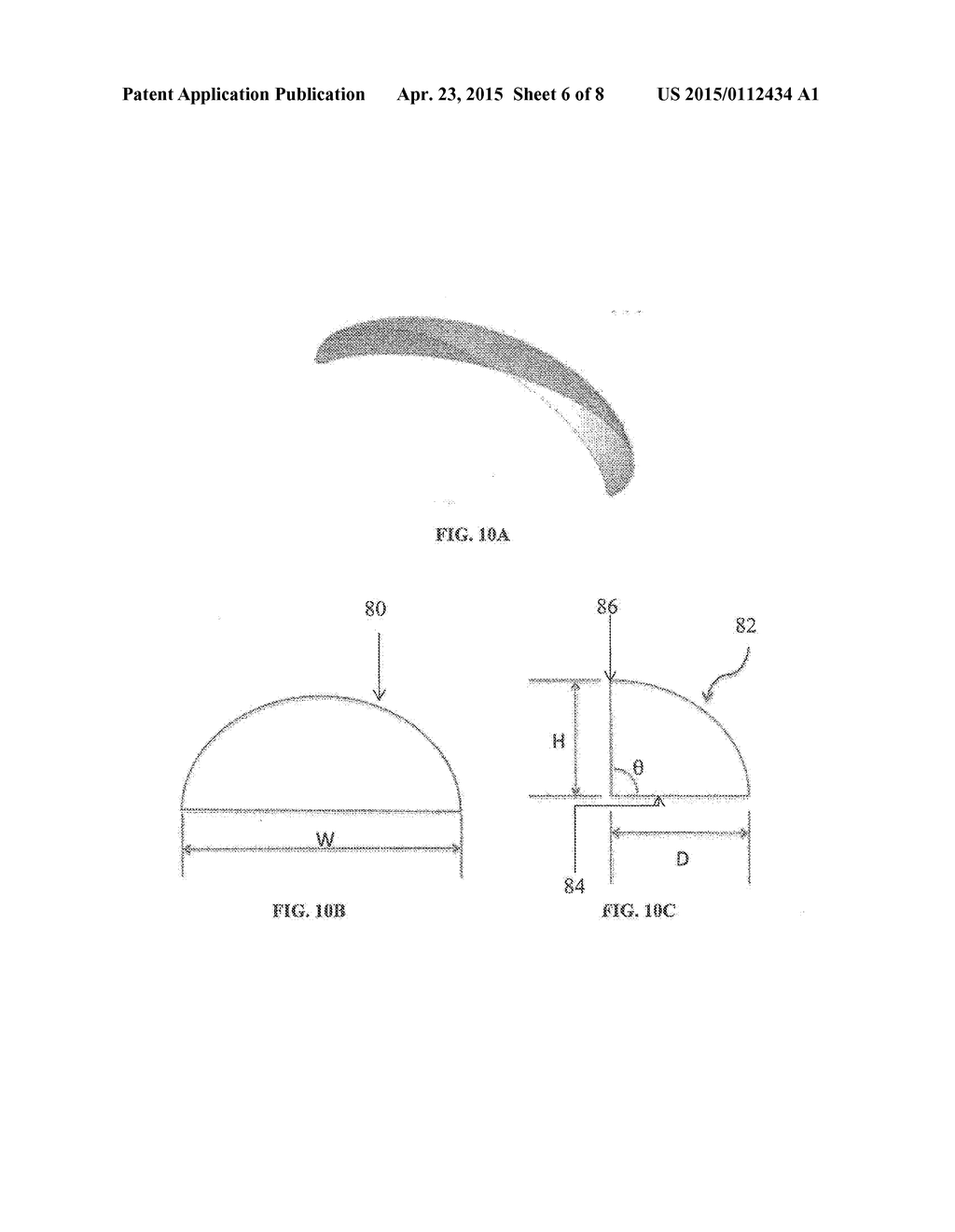 ABSORBABLE IMPLANTS FOR PLASTIC SURGERY - diagram, schematic, and image 07