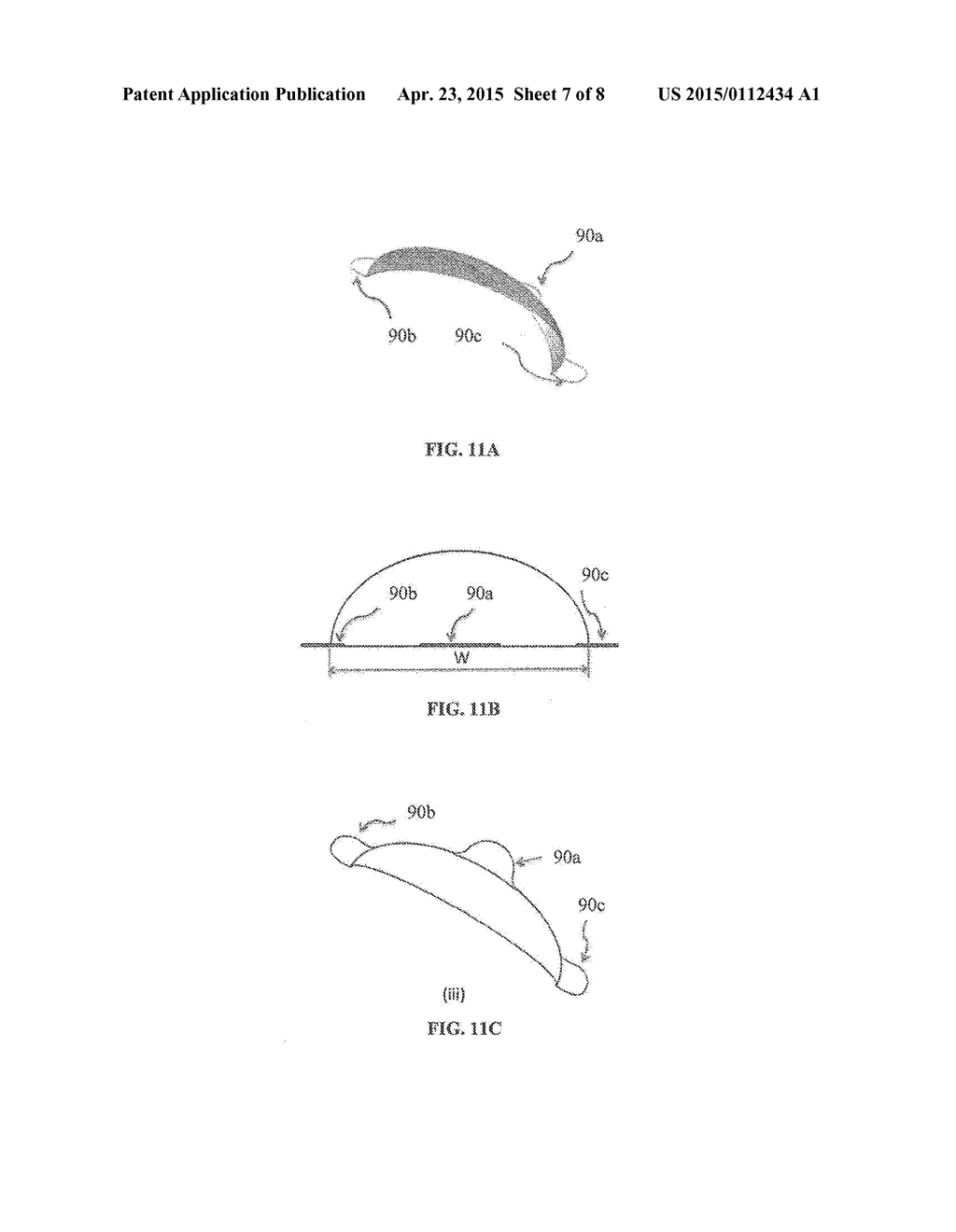 ABSORBABLE IMPLANTS FOR PLASTIC SURGERY - diagram, schematic, and image 08