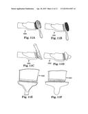 VACUUM GROOMING TOOL diagram and image