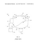 RECIRCULATION BLOCK diagram and image