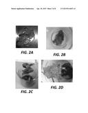 METHOD FOR REMEDIATION OF SUBTERRANEAN-FORMED METAL-POLYMER COMPLEXES     USING A METAL COMPLEXING AGENT diagram and image