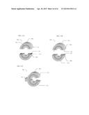 THERAPY DELIVERY DEVICE FOR ANASTOMOTIC JOINING OF TISSUE diagram and image