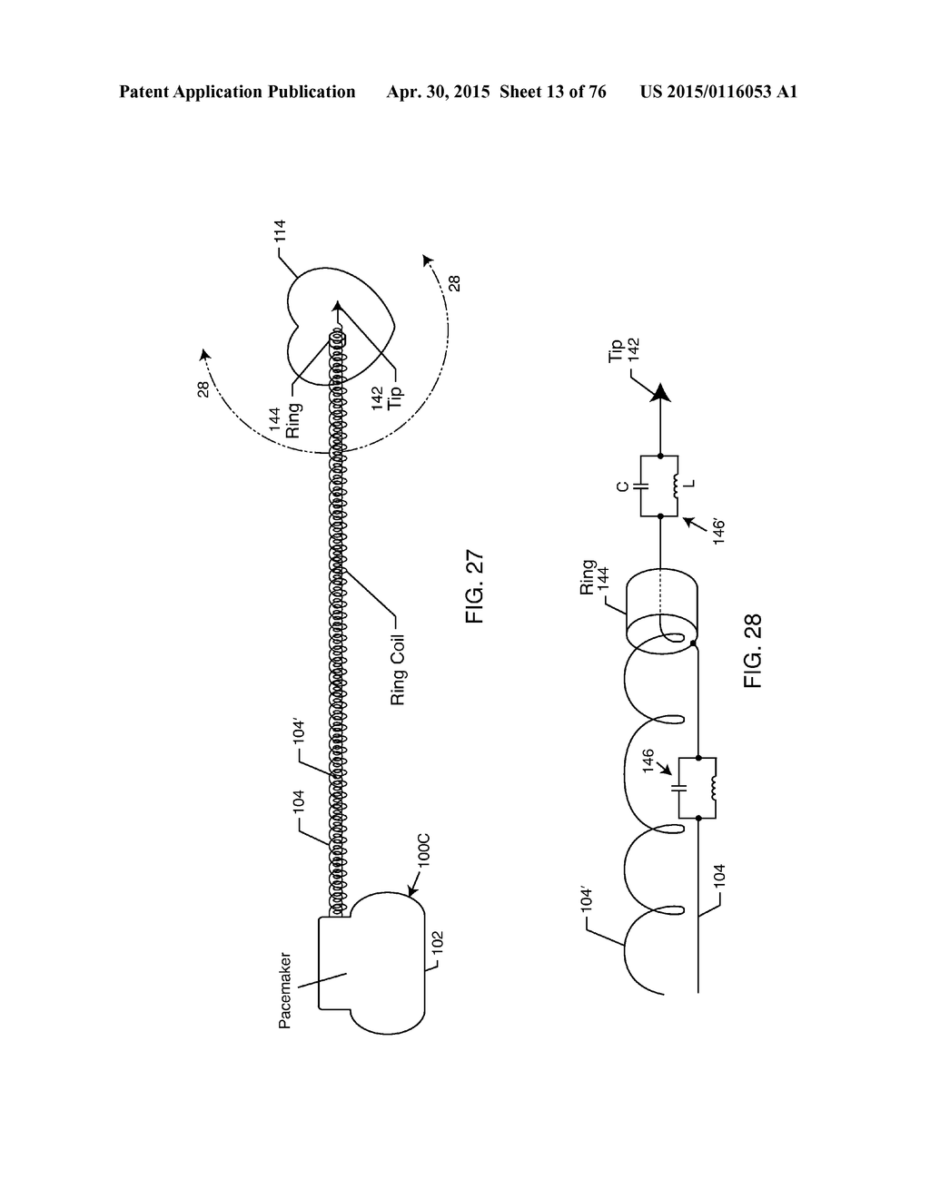 HEADER EMBEDDED FILTER FOR IMPLANTABLE MEDICAL DEVICE - diagram, schematic, and image 14