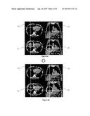 MEDICAL IMAGE DATA PROCESSING APPARATUS AND METHOD diagram and image