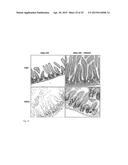 STROMAL CELL THERAPY IN TREATMENT OF RADIATION INJURY diagram and image