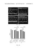 COMPOSITIONS AND METHODS FOR TREATING CARDIAC HYPERTROPHY diagram and image