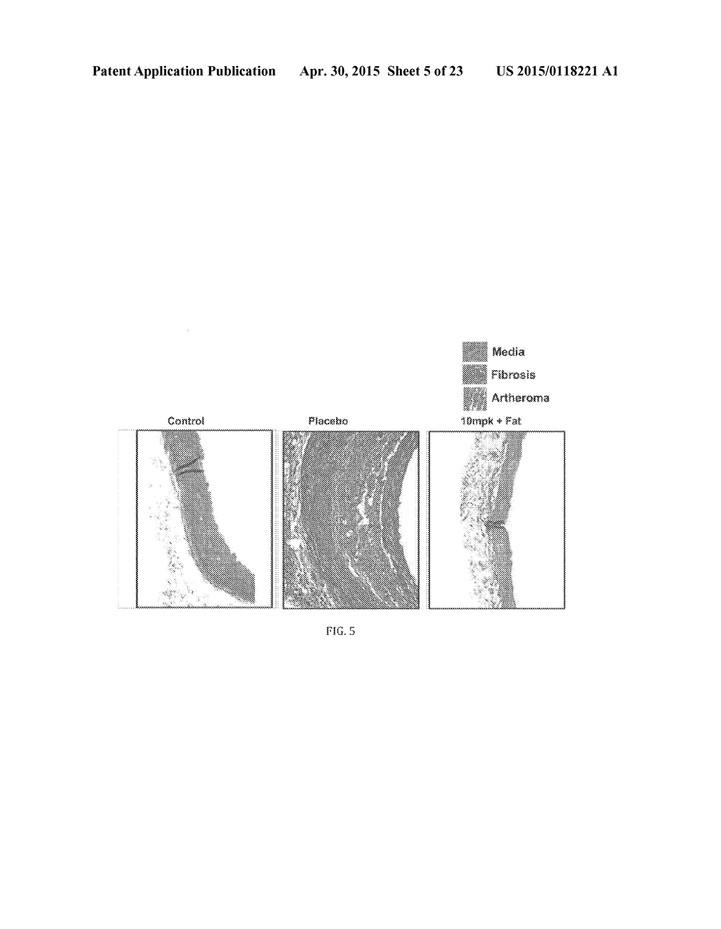 COMPOSITIONS AND METHODS FOR TREATING CARDIAC HYPERTROPHY - diagram, schematic, and image 06