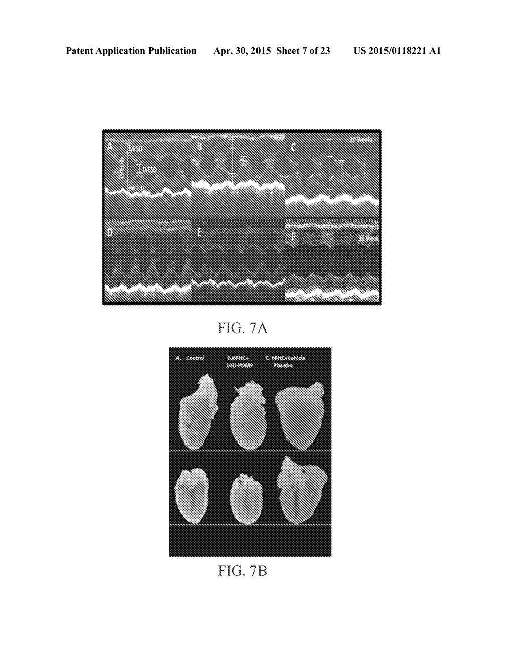 COMPOSITIONS AND METHODS FOR TREATING CARDIAC HYPERTROPHY - diagram, schematic, and image 08