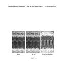 COMPOSITIONS AND METHODS FOR TREATING CARDIAC HYPERTROPHY diagram and image