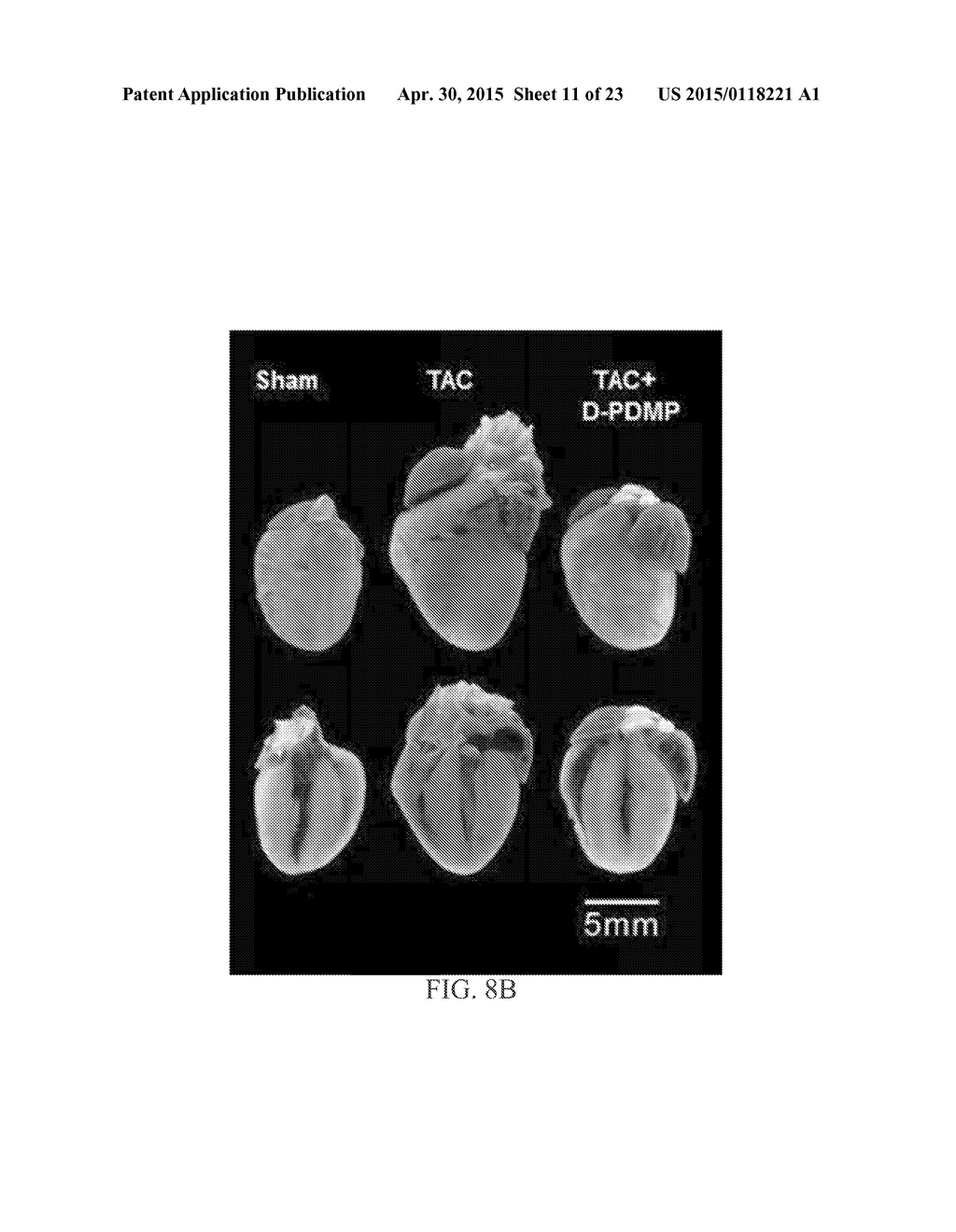 COMPOSITIONS AND METHODS FOR TREATING CARDIAC HYPERTROPHY - diagram, schematic, and image 12