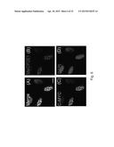 MeCP2 ISOFORM-SPECIFIC ANTIBODY FOR DETECTION OF ENDOGENOUS EXPRESSION OF     MeCP2E1 diagram and image