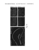 MeCP2 ISOFORM-SPECIFIC ANTIBODY FOR DETECTION OF ENDOGENOUS EXPRESSION OF     MeCP2E1 diagram and image