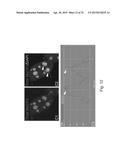 MeCP2 ISOFORM-SPECIFIC ANTIBODY FOR DETECTION OF ENDOGENOUS EXPRESSION OF     MeCP2E1 diagram and image