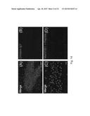 MeCP2 ISOFORM-SPECIFIC ANTIBODY FOR DETECTION OF ENDOGENOUS EXPRESSION OF     MeCP2E1 diagram and image