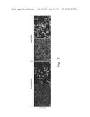 MeCP2 ISOFORM-SPECIFIC ANTIBODY FOR DETECTION OF ENDOGENOUS EXPRESSION OF     MeCP2E1 diagram and image