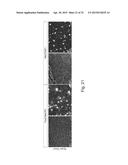 MeCP2 ISOFORM-SPECIFIC ANTIBODY FOR DETECTION OF ENDOGENOUS EXPRESSION OF     MeCP2E1 diagram and image