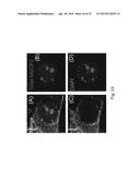 MeCP2 ISOFORM-SPECIFIC ANTIBODY FOR DETECTION OF ENDOGENOUS EXPRESSION OF     MeCP2E1 diagram and image