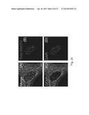 MeCP2 ISOFORM-SPECIFIC ANTIBODY FOR DETECTION OF ENDOGENOUS EXPRESSION OF     MeCP2E1 diagram and image