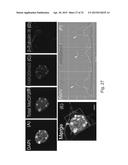 MeCP2 ISOFORM-SPECIFIC ANTIBODY FOR DETECTION OF ENDOGENOUS EXPRESSION OF     MeCP2E1 diagram and image