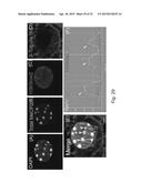 MeCP2 ISOFORM-SPECIFIC ANTIBODY FOR DETECTION OF ENDOGENOUS EXPRESSION OF     MeCP2E1 diagram and image