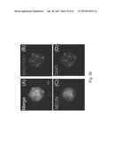 MeCP2 ISOFORM-SPECIFIC ANTIBODY FOR DETECTION OF ENDOGENOUS EXPRESSION OF     MeCP2E1 diagram and image